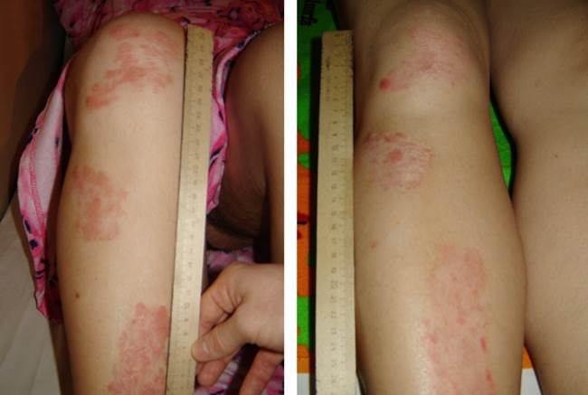 Отзывы на солярий