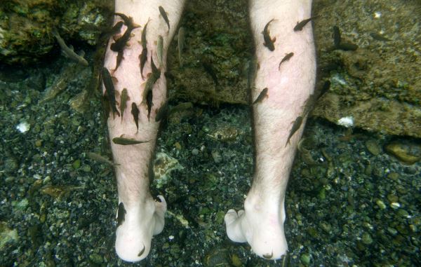 Лечение псориаза в Кангале