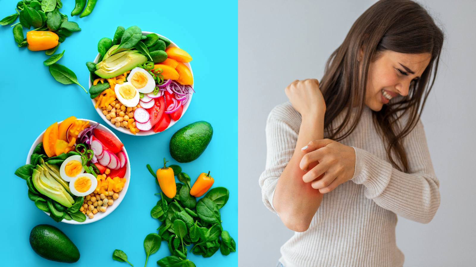 Диета при псориазе