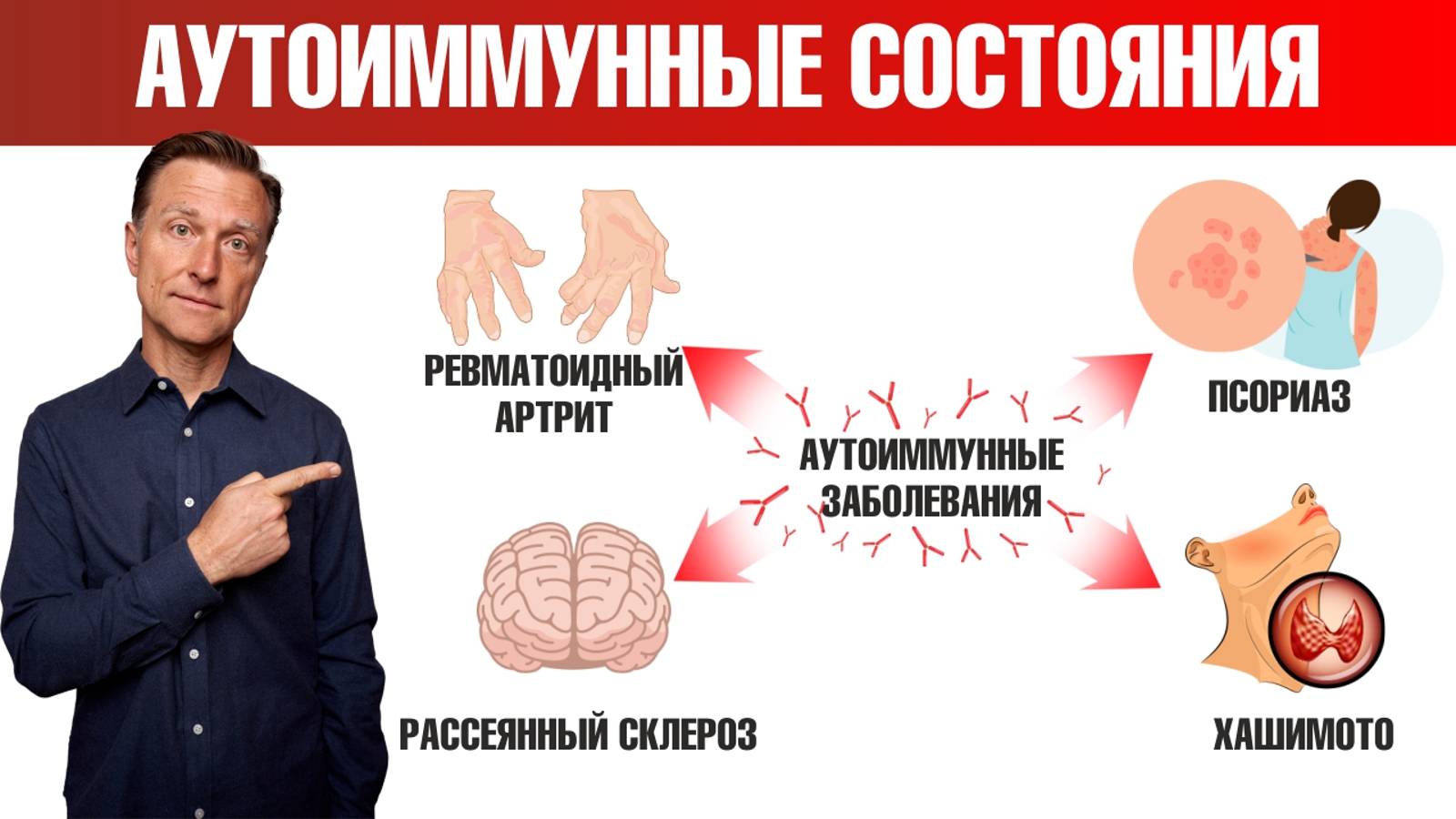 Псориаз аутоиммунное заболевание или нет