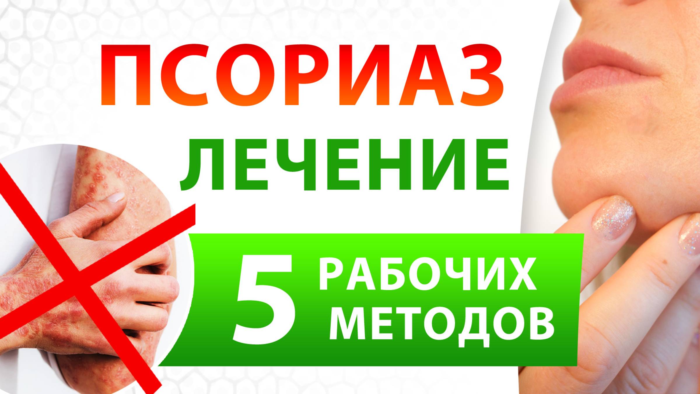 К какому врачу обращаться с псориазом