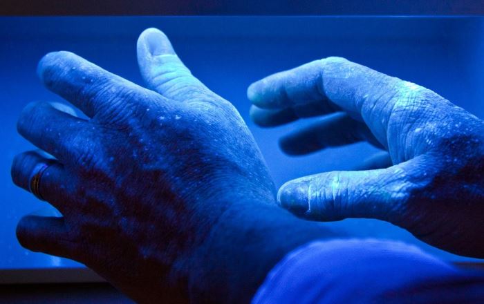 ПУВА терапия при псориазе