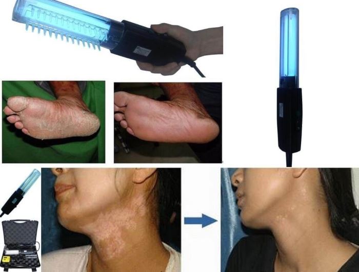 УФ-расческа